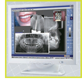 Digital radiography